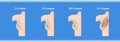 Опухоль молочной железы у собаки (рак): фотографии, лечение.