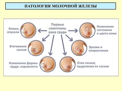 BI-RADS — исследование молочных желез — 24Radiology.ru