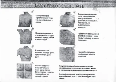 Опухоль молочной железы у собаки (рак): фотографии, лечение.