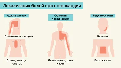 Укрепление общественного здоровья