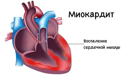 Этиология, патогенез, клиническая диагностика, дифференциальная диагностика  и лечение острых нарушений мозгового кровообращения