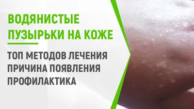 Покрытие ногтей гель-лаком в салоне - «Об этом вам не расскажут в  салоне..что стало с моими руками ,после нескольких месяцев использования  гель лака? » | отзывы