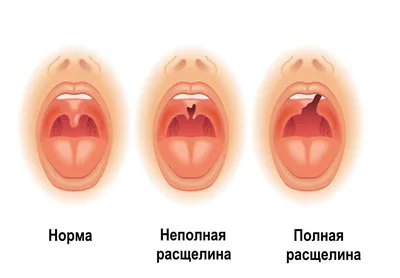 Волчья пасть фото