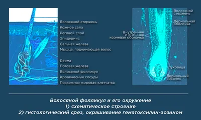 Сколько сеансов эпиляции потребуется клиенту? Стадии роста волос.