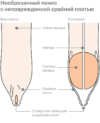 Баланит и баланопостит: симптомы, диагностика и лечение в клинике Universum  Clinic