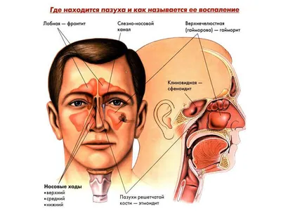 Лечение гайморита в Казани, диагностика и причины гайморита | Медицинская  клиника \"МЕДЭКСПЕРТ\"