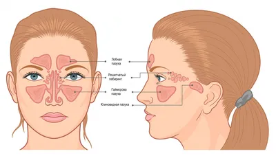 Лечение синусита у детей | ЛОР КЛИНИКА ЗАЙЦЕВА | Дзен