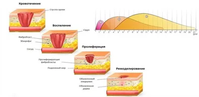 Стадии формирования рубцов | Блог пластического хирурга