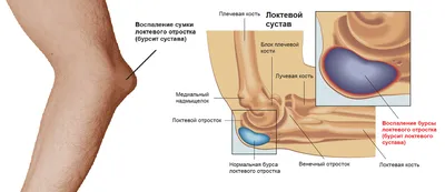 Послеоперационные раны: правила и особенности ухода