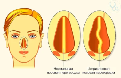 Ильинская больница - современный амбулаторно-госпитальный центр :: Зачем  нужен дренаж, и как заживает рана после операции на молочной железе