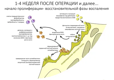 Рисунок 8 – Общий вид глаза после завершения операции и наложени…