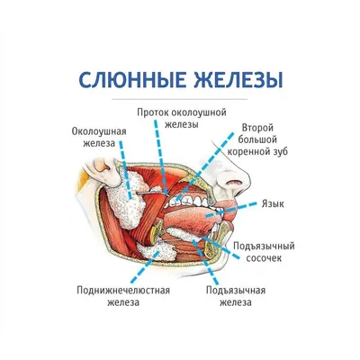 Сиалоаденит. Слюнокаменная болезнь. Воспаление слюнной железы. Камни в  протоке слюнной железы. - YouTube