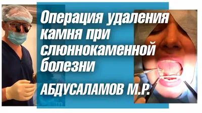 Сиалография слюнных желез | ЧЛГ ВВ ДЗМ