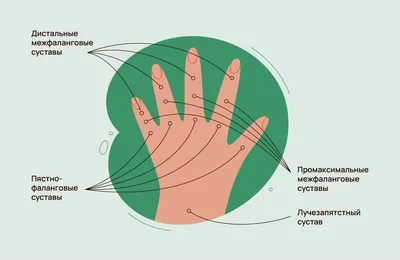 Теносиновит де Кервена - KinesioPro