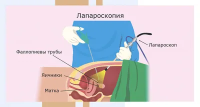 Экзостоз челюсти [симптомы, лечение и удаление остеофита в стоматологии]