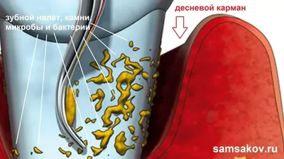 Гной на языке: причины образования и советы по лечению