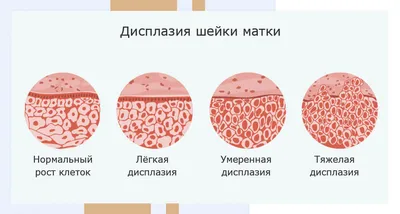 Анальная боль и зуд в заднем проходе: что делать — блог медицинского центра  ОН Клиник