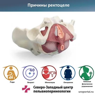 Фарингитом называется воспаление слизистой оболочки задней стенки зева ( воспаление глотки). Глотка – это верхняя часть горла. Глотка… | Instagram