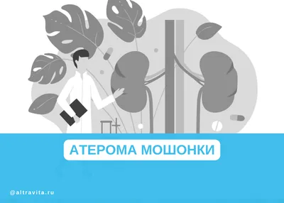 Атерома мошонки: симптомы и лечение атеромы на яичках и половом члене в  Москве