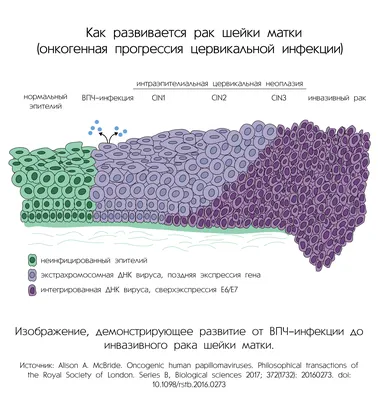 Вирус папилломы человека: где можно заразиться, какие виды способны  привести к раку и кому нужна вакцинация