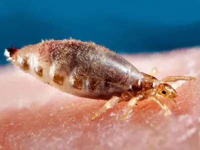 Платяная вошь (Pediculus vestimenti de Geer) | Anodonta.com.ua