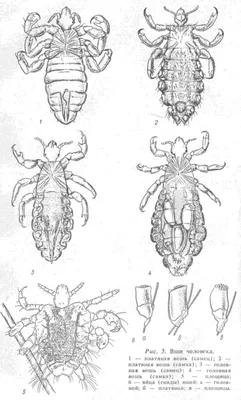 О подкожных вшах у человека мифы и реальность