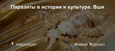 Откуда берутся вши, как бороться с вшами в домашних условиях