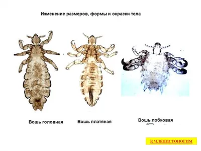 Вши – как они попадают в волосы человека? Чем питаются и как с ними  бороться?