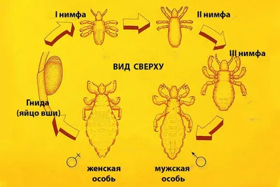 68. Вши. Систематическое положение. Особенности строения, биология,  представители, значение.