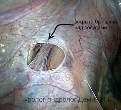 Порезаные вены~Эстетика~ | Мрачные фотографии, Эстетика, Фотографии