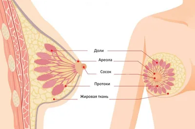 Аденоз молочных желез – симптомы предракового состояния молочной железы |  Клиники «Евроонко»