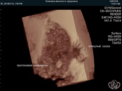 Памятка для граждан о гарантиях бесплатного оказания медицинской помощи