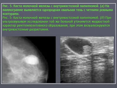 Всероссийская акция \"Сохраним жизнь маме!\" - БУ \"Нижневартовская городская  поликлиника\"