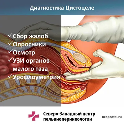 Вульводиния – что это, симптомы, причины, диагностика и лечение у женщин в  клинике «Будь Здоров»