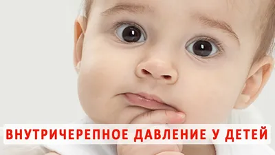 Большой родничок у ребенка - Школа Кроха