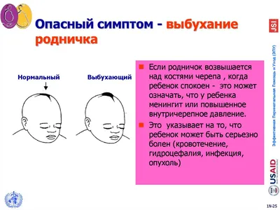 Гемолитическая болезнь новорожденных | Пикабу