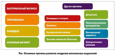 4 симптома бактериального вагиноза