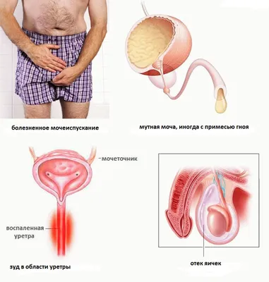 Аногенитальный герпес – заболевание, которое вызывается вирусом простого  герпеса (ВПГ) 1 и/или 2 типа. ✏️На заметку: Чаще всего герпес… | Instagram