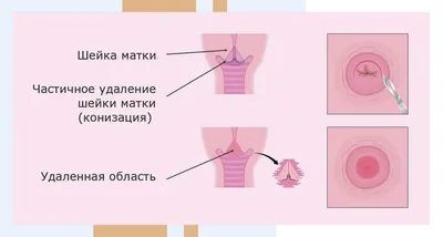 Острый вагинит – причины, симптомы, диагностика и лечение в «Будь Здоров»