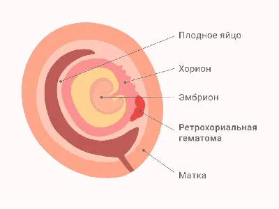 Кровит, 7+6 — 53 ответов | форум Babyblog