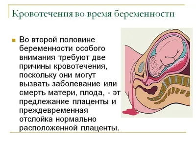 Слизистые выделения при беременности: почему появляются на ранних и поздних  сроках, в 1, 2 и 3 триместре, что делать в домашних условиях