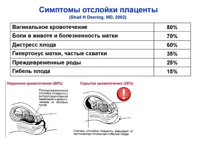 Как я родила с отслойкой плаценты