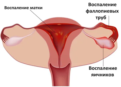 Отличие овуляции от менструации: ключевое понимание женского цикла