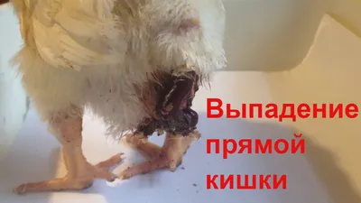 ШОК!!! ВЫПАДЕНИЕ ПРЯМОЙ КИШКИ!! что делать? - YouTube