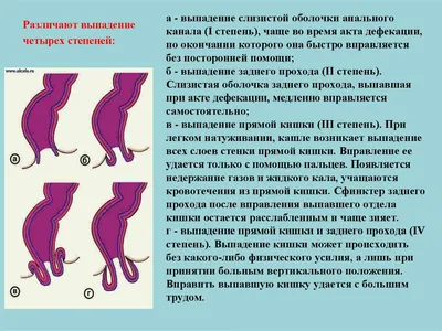 Выпадение прямой кишки у ребенка. Чем опасно длительное сидение на горшке?  - YouTube