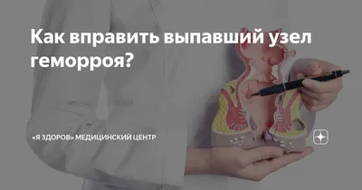 Как вправить выпавший узел геморроя? | Сеть медицинских центров «Я здоров!»  | Дзен