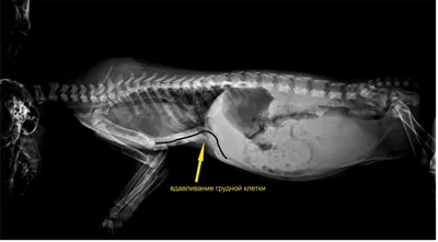 Вывихи акромиального, грудинного концов ключицы – симптомы травмы, первая  помощь и лечение, реабилитация – Отделение травматологии НКЦ №2 (ЦКБ РАН)