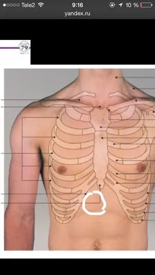 Торчит кость на грудой клетке с правой стороны - Вопрос  ортопеду-травматологу - 03 Онлайн