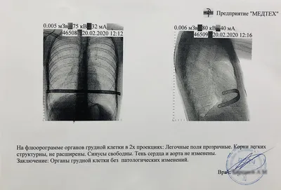 Шишка между внизу грудной клетки по середине — 36 ответов | форум Babyblog