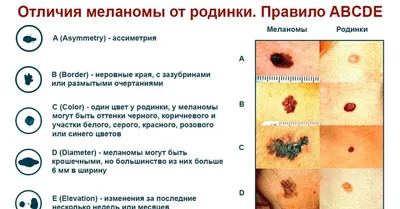 Важная информация об образованиях на коже